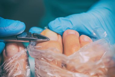 Pedikür sırasında peeling