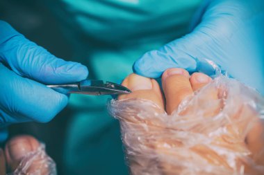 Pedikür sırasında peeling