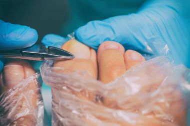 Pedikür sırasında peeling