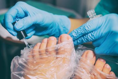 Pedikür sırasında peeling