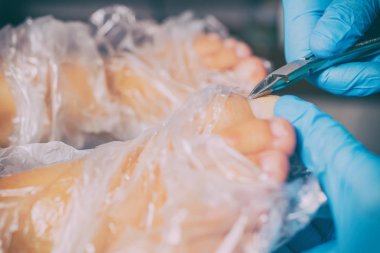 Pedikür sırasında peeling