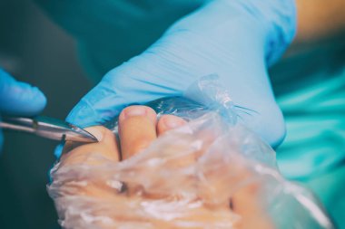 Pedikür sırasında peeling