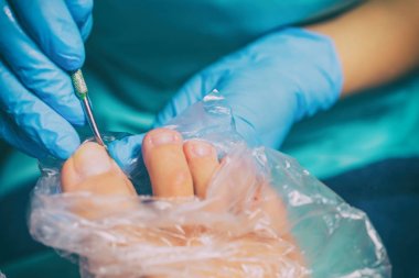 Pedikür sırasında peeling