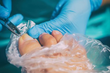 Pedikür sırasında peeling