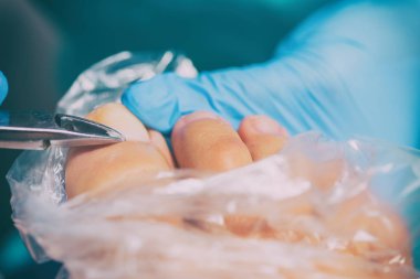 Pedikür sırasında peeling