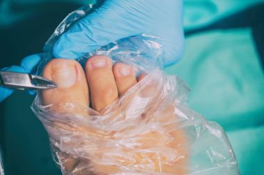 Pedikür sırasında peeling