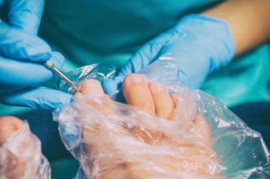 Pedikür sırasında peeling