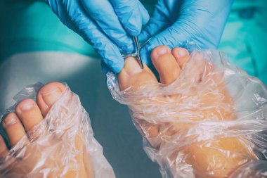 Pedikür sırasında peeling