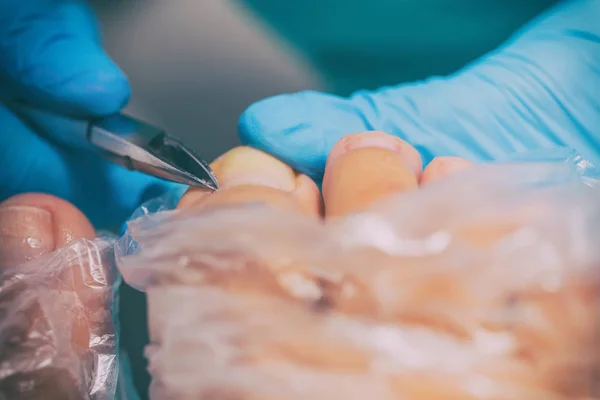 Peeling during a pedicure — Stock Photo, Image