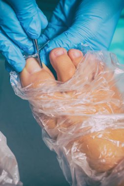 Pedikür sırasında peeling