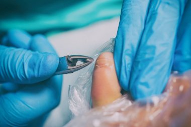 Pedikür ölü deri temizleyici ayak törpülemek kadın tırnak Salonu