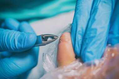 Pedikür ölü deri temizleyici ayak törpülemek kadın tırnak Salonu