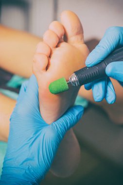 Pedikür portre. kütikül kaldırma