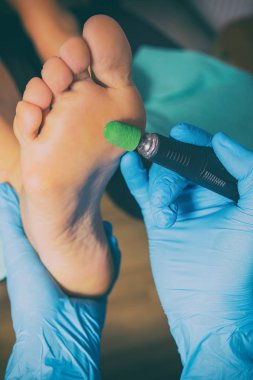 Pedikür portre. kütikül kaldırma