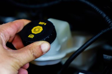 Arabanın motoru teknik onay