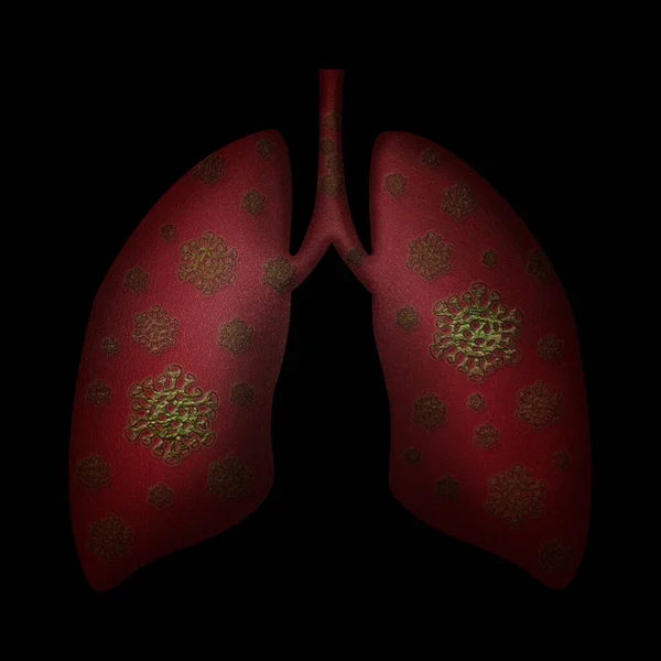 Icono Los Pulmones Covid Signo Pulmones Con Icono Del Virus — Foto de Stock