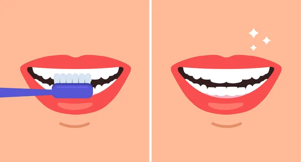 Cepillado Limpieza Dientes Pasos Concepto Ilustración Dibujos Animados Diseño Gráfico — Vector de stock