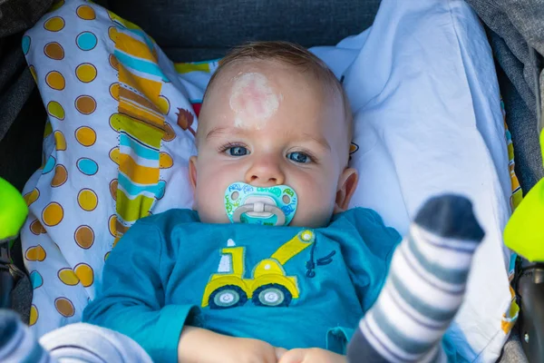 Close up of baby injury. Baby\'s expression and the scar on the forehead after he hits his head on the ground.