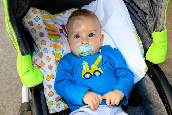 Nahaufnahme von Babyverletzungen. Der Gesichtsausdruck des Babys und die Narbe auf der Stirn, nachdem er seinen Kopf auf den Boden geschlagen hatte. Baby im Kinderwagen. — Stockfoto