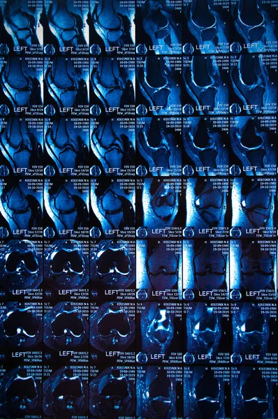 Хірург Рентгенографія Коліна Крупним Планом — стокове фото