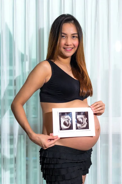 Pregnant woman with ultrasound paper — Stock Photo, Image