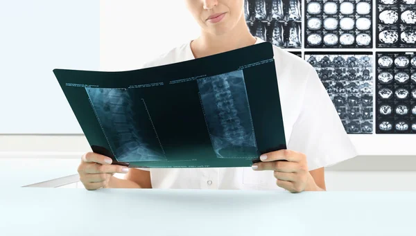 Radiolog kvinna kontrollera xray, hälsovård, medicinska och införa — Stockfoto