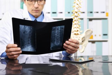 Radiologist doctor checking xray, healthcare, medical and radiol