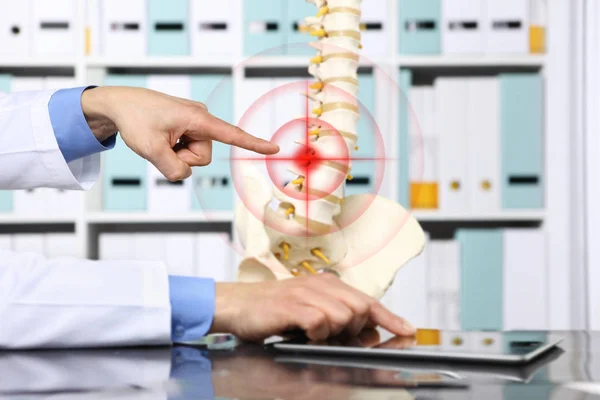 Tangan dokter menunjuk kerangka tulang belakang, hernia konsep penyebab — Stok Foto