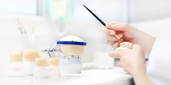 Стоматолог руки, що працюють з зубними протезами в своїй роботі — стокове фото