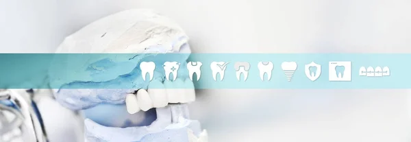 Dental ferramenta conceito articulador técnico com ícones de dentes e — Fotografia de Stock