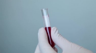 Tek kullanımlık laboratuvar eldivenlerindeki eller bir test tüpünü kanla kapatın.