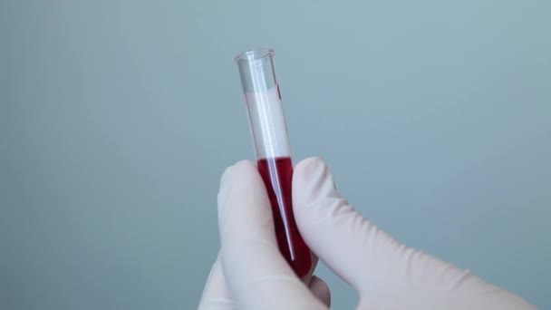 Mani Guanto Monouso Laboratorio Chiudere Una Provetta Con Sangue — Video Stock