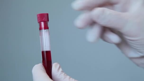 Kezek egy eldobható laboratóriumi kesztyű tartó vizsgálati cső vérrel — Stock videók
