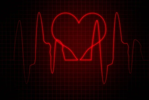 Heart rate monitoring. heart chart. heart cardiogram — Stock Photo, Image