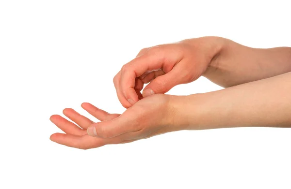 Cosmetic defect, irritation of the skin of hands, isolated on white — Stock Photo, Image