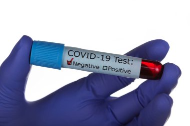 Elinde lateks eldivenle Covid-19 kan testi formunun önünde kan örneği şişesi tutuyor. Beyaz arkaplanda izole.