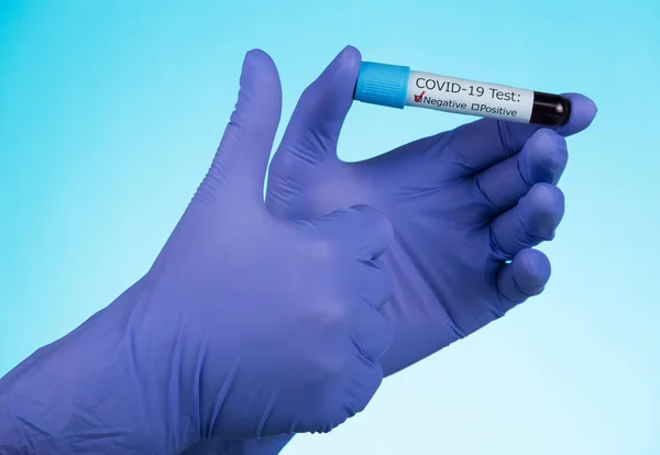Covid 19血液検査フォームの前にラテックス手袋を保持血液サンプルバイアルと手 青の背景に — ストック写真