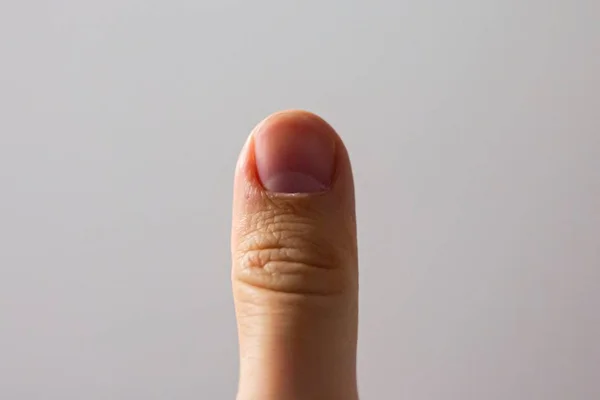 Close-up van een menselijke duim onder de lichten tegen een witte achtergrond — Stockfoto