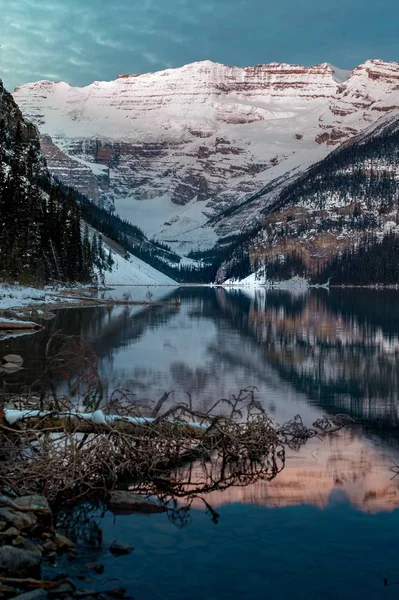Pionowe Ujęcie Zaśnieżonych Gór Odbitych Jeziorze Louise Kanadzie — Zdjęcie stockowe