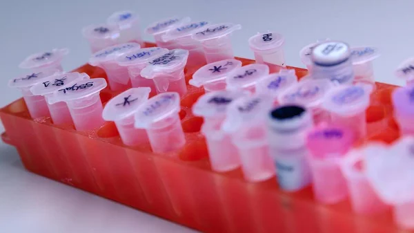 Close Dicas Pipeta Laboratório Recipiente Vermelho Usado Para Pesquisa Coronavírus — Fotografia de Stock