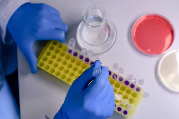 Pipetlerle Koronavirüs Testi Yapan Birinin Yüksek Açılı Yakın Plan Çekimi — Stok fotoğraf