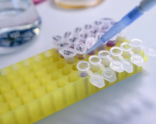 Pipetlerle Koronavirüs Testi Yapan Birinin Yakın Plan Fotoğrafı — Stok fotoğraf