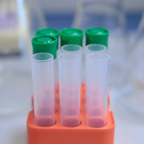 Primer Plano Tubos Plástico Laboratorio Utilizados Para Investigación Del Coronavirus —  Fotos de Stock