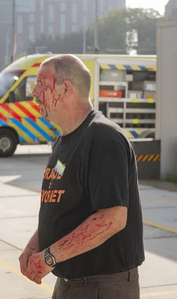 Amsterdam Netherlands Eylül 2011 Kafasından Kolundan Yaralanan Bir Erkek Hasta — Stok fotoğraf