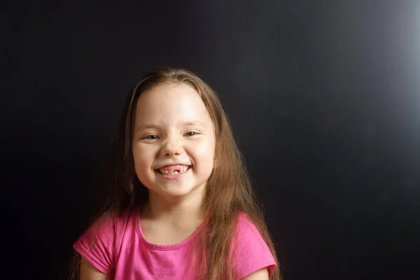 Πορτρέτο ενός γοητευτικού κοριτσιού που γελάει με πεσμένα δόντια — Φωτογραφία Αρχείου