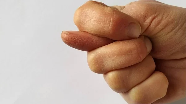 It's a fig. A fist with a thumb stuck between the index and middle. A rude gesture indicating mockery, contempt, and a desire to humiliate an opponent. Failure in a rude manner