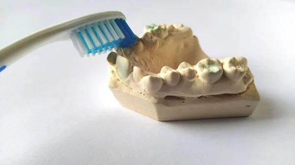 Зубная щетка и насмешка над человеческой челюстью. Гипсовая нижняя челюсть. Концепция стоматологической и медицинской помощи. Белый фон. Ярко-желтый и синий цвета. Крепкие, кривые зубы. Помощь стоматолога и ортодонта — стоковое фото