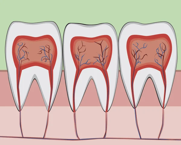 Uma estrutura molar com esmalte e nervos na gengiva e mandíbula, um f —  Vetores de Stock