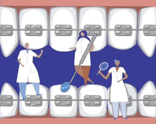 Orthodontistes Traitent Les Grandes Dents Molaires Dans Bouche Illustration Plate — Image vectorielle