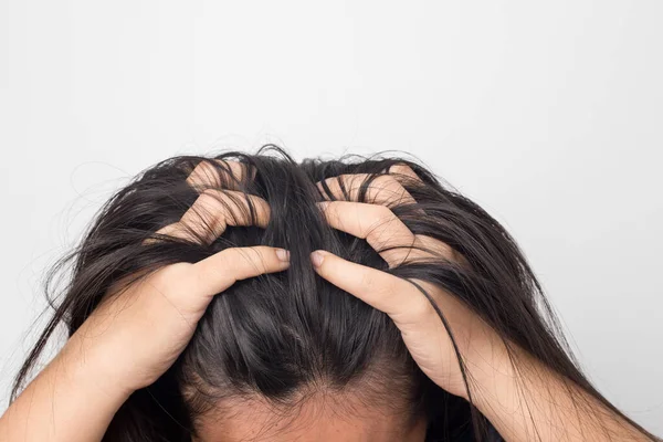 Nők Viszkető Fejbőr Sérült Haj Hajápolási Koncepció — Stock Fotó